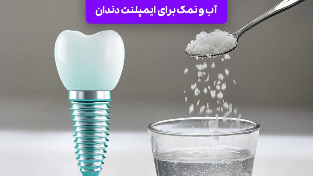 آب و نمک برای ایمپلنت دندان