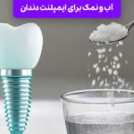 آب و نمک برای ایمپلنت دندان