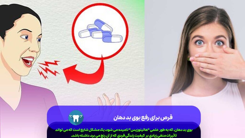 قرص برای رفع بوی بد دهان