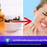 میخک برای دندان درد